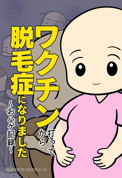 ワクチン打ってから脱毛症になりました～おハゲ記録～