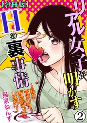 リアル女子が明かすＨの裏事情～私のセックス、まちがっている!?～【分冊版】